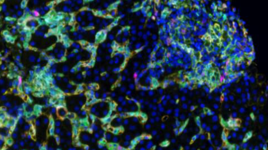 Deep learning improves the accuracy of multispectral image analysis for digital pathology