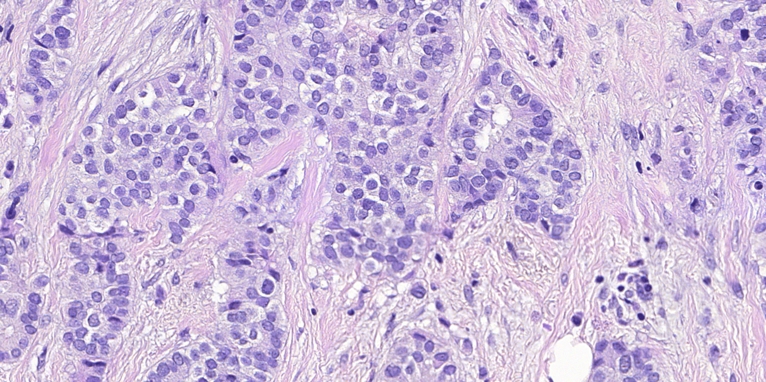 FFEI’s Sierra Colour Calibration Technology integrated into Visiopharm’s Pathology Viewer Solution