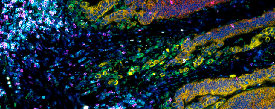 Lunaphore and Visiopharm announce new partnership to offer spatial biology research solution with deep learning technology
