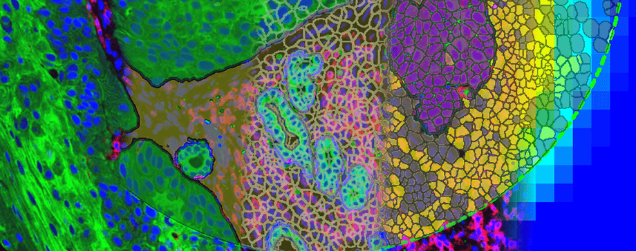 NanoString and Visiopharm announce collaboration to co-develop integrated workflows for GeoMx and AtoMx spatial biology solutions