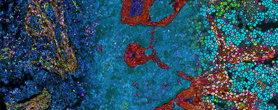 Standard BioTools and Visiopharm announce partnership for the development of complete image analysis solutions to be packaged with Hyperion and Hyperion+ Imaging Systems