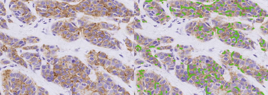 Massachusetts General Hospital and Visiopharm enter collaborative research pilot