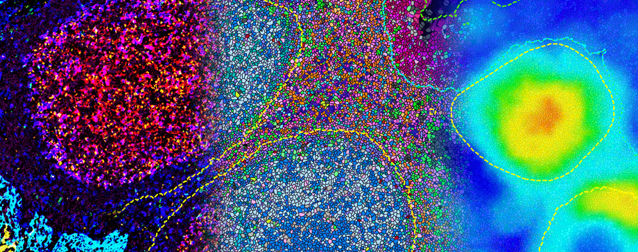 Visiopharm introduces Phenoplex™, a unified solution for a better multiplex image analysis workflow