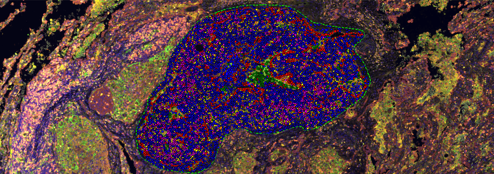 Glint Lab’s Journey with Visiopharm Software