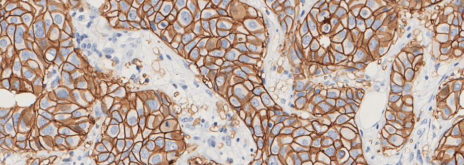 Agilent announces end-to-end digital pathology workflow solution for USCAP 2023