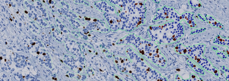 Minerva Imaging and Visiopharm announce collaboration on AI-based image analysis