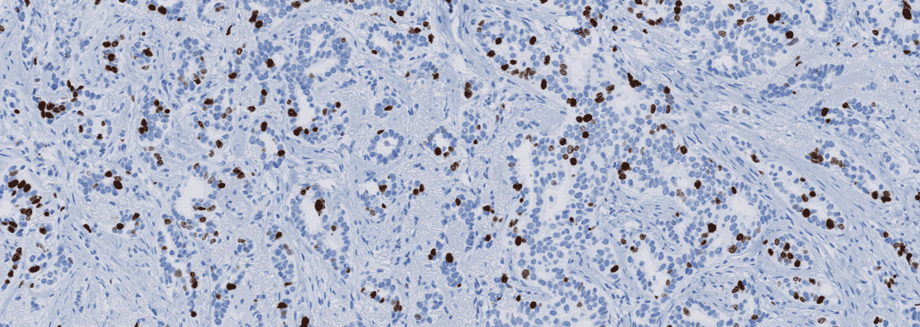 Visiopharm supports urgent call for improved quality assurance in immunohistochemistry with AI-based software tools