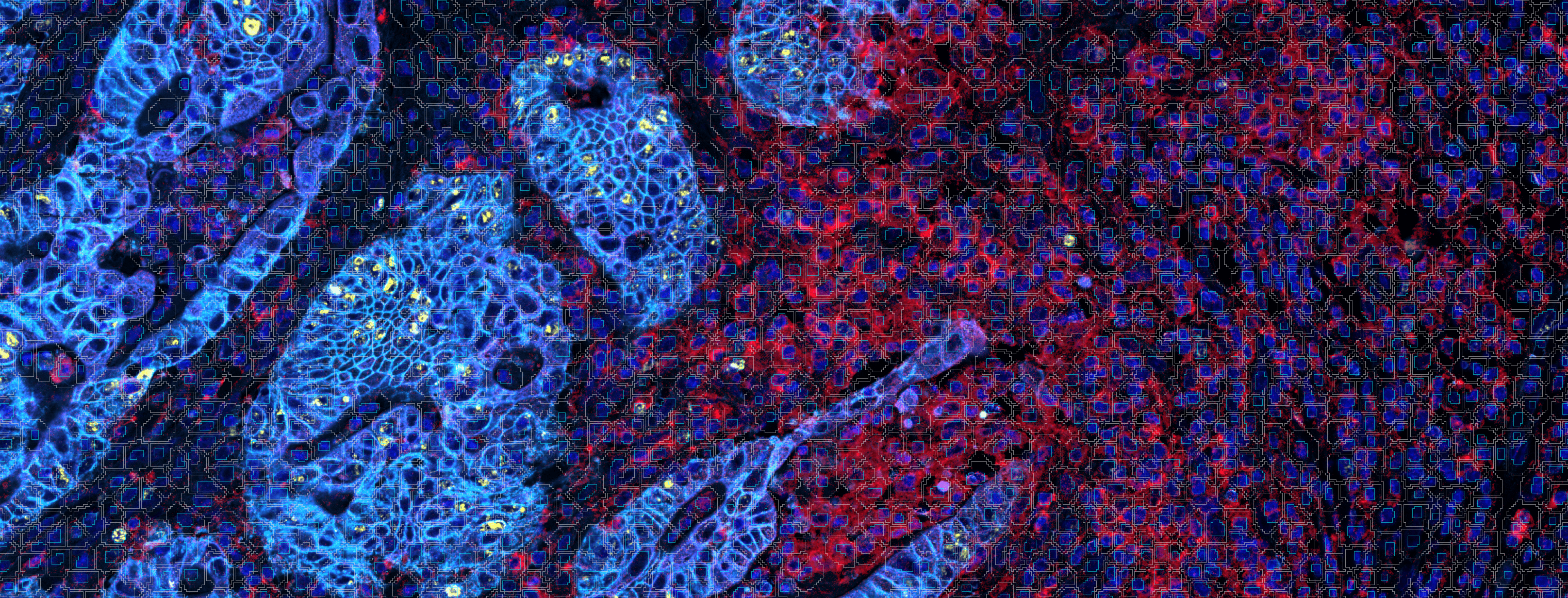 A Guide to Cell Segmentation in Multiplex Tissue Imaging with AI