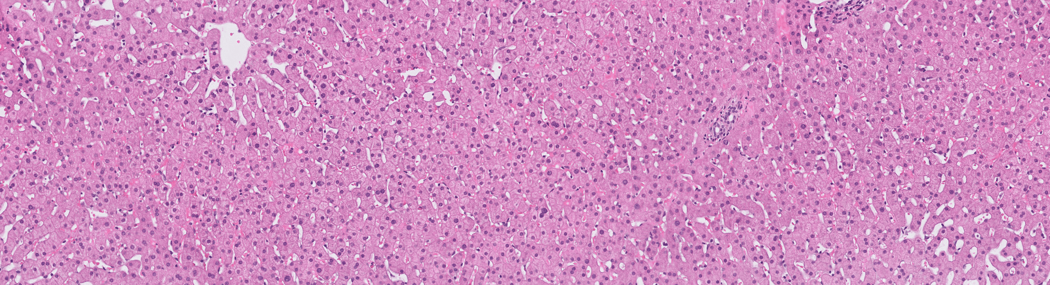 Visiopharm liver tissue research